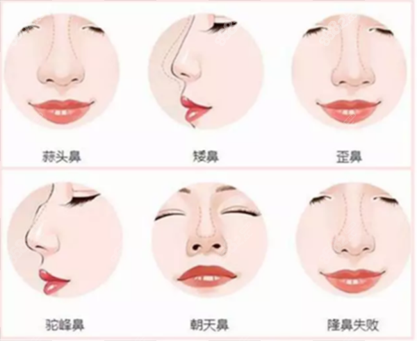 成都隆鼻前十名都有誰