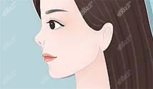 朝天鼻側(cè)面動(dòng)畫展示圖 朝天鼻側(cè)面動(dòng)畫展示圖