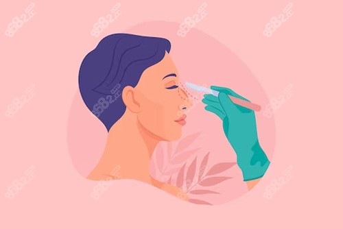 鼻部修復(fù)示意圖 鼻部修復(fù)示意圖