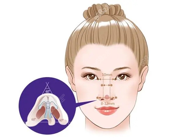 成都鼻綜合出名的醫(yī)生 成都鼻綜合出名的醫(yī)生