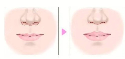 人中太長(zhǎng) 人中太長(zhǎng)