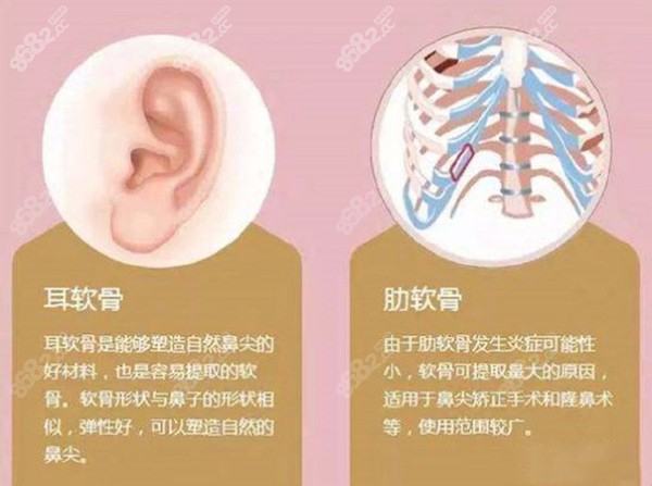 成都隆鼻前十名都有誰