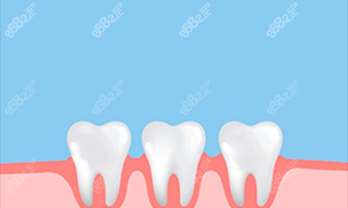 牙齒動畫展示圖 牙齒動畫展示圖