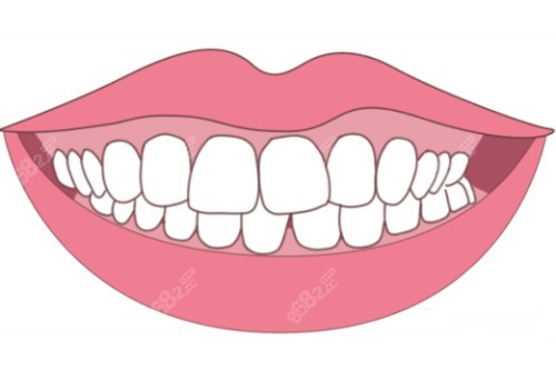 想了解阜陽康齒佳口腔？種植牙矯正牙項目全，環(huán)境服務(wù)好收費也清晰！