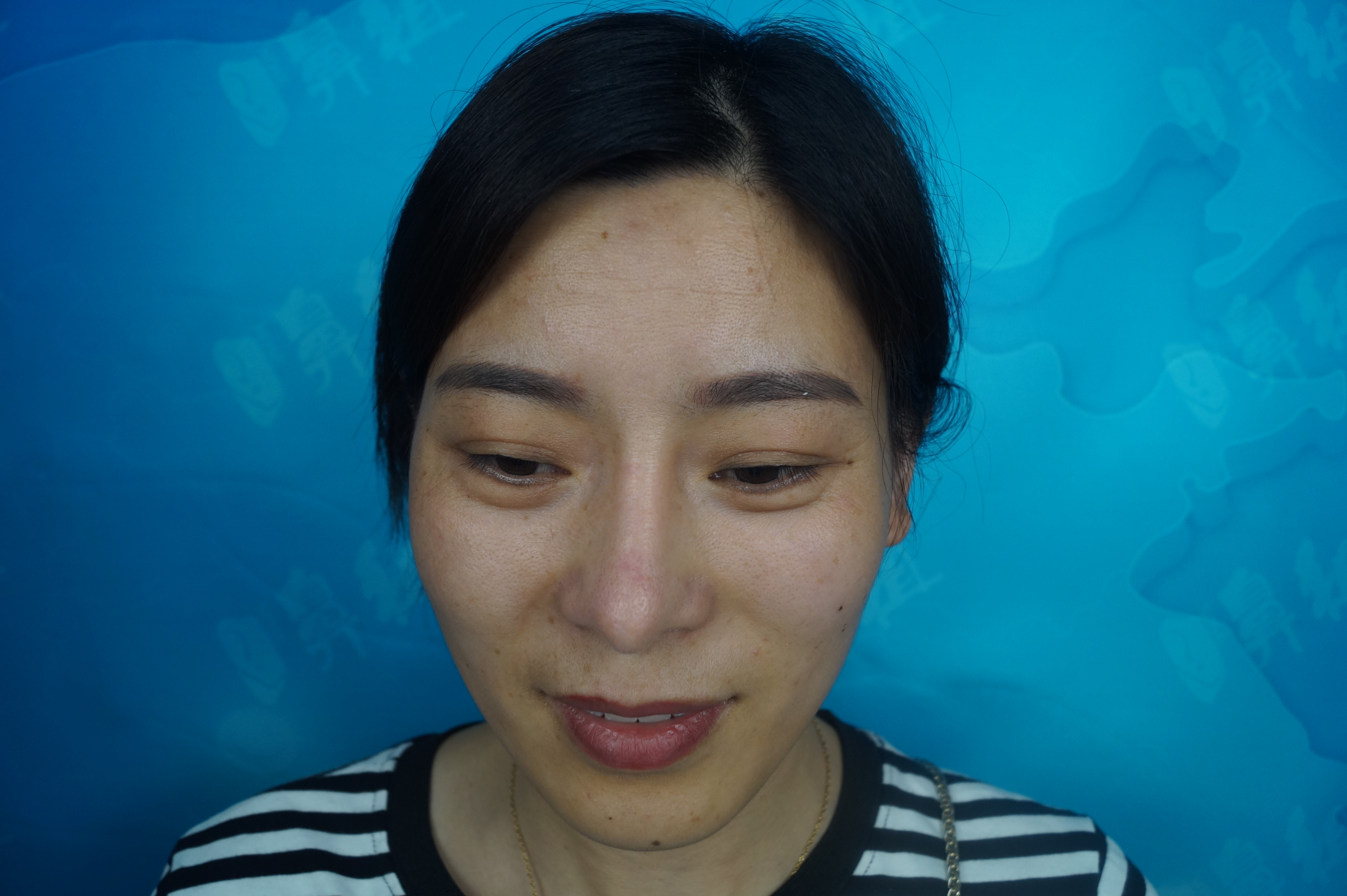 南京康美正規(guī)透明，讓求美者放心變得更美