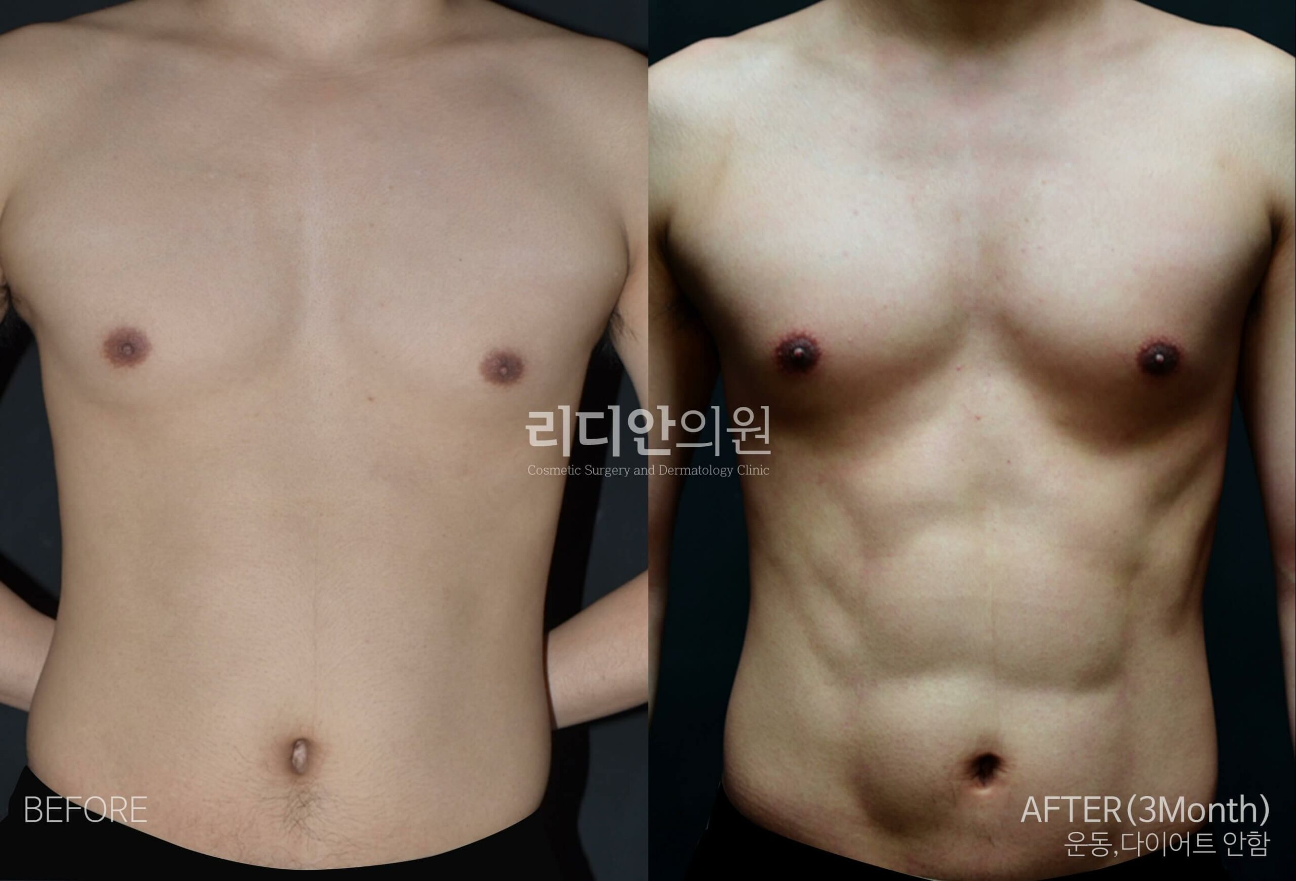 深圳內(nèi)窺鏡額頭提升醫(yī)生名單——深圳曹孟君醫(yī)療美容門診部