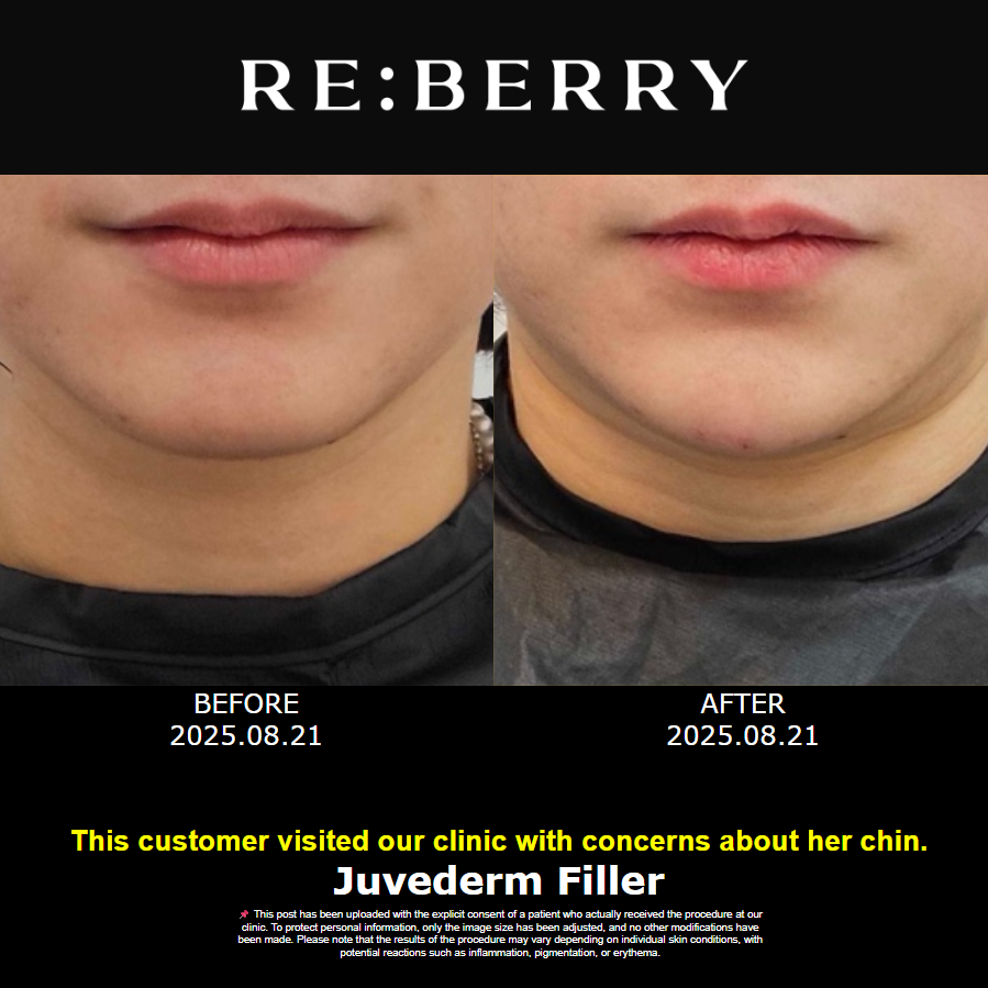 四、馮安明塑形的其他真實(shí)實(shí)例參考