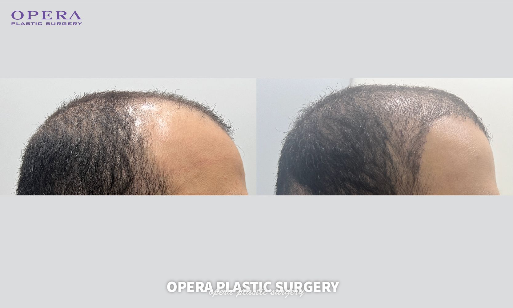 上海瑞格醫(yī)療美容門診部預(yù)約流程是怎樣的？