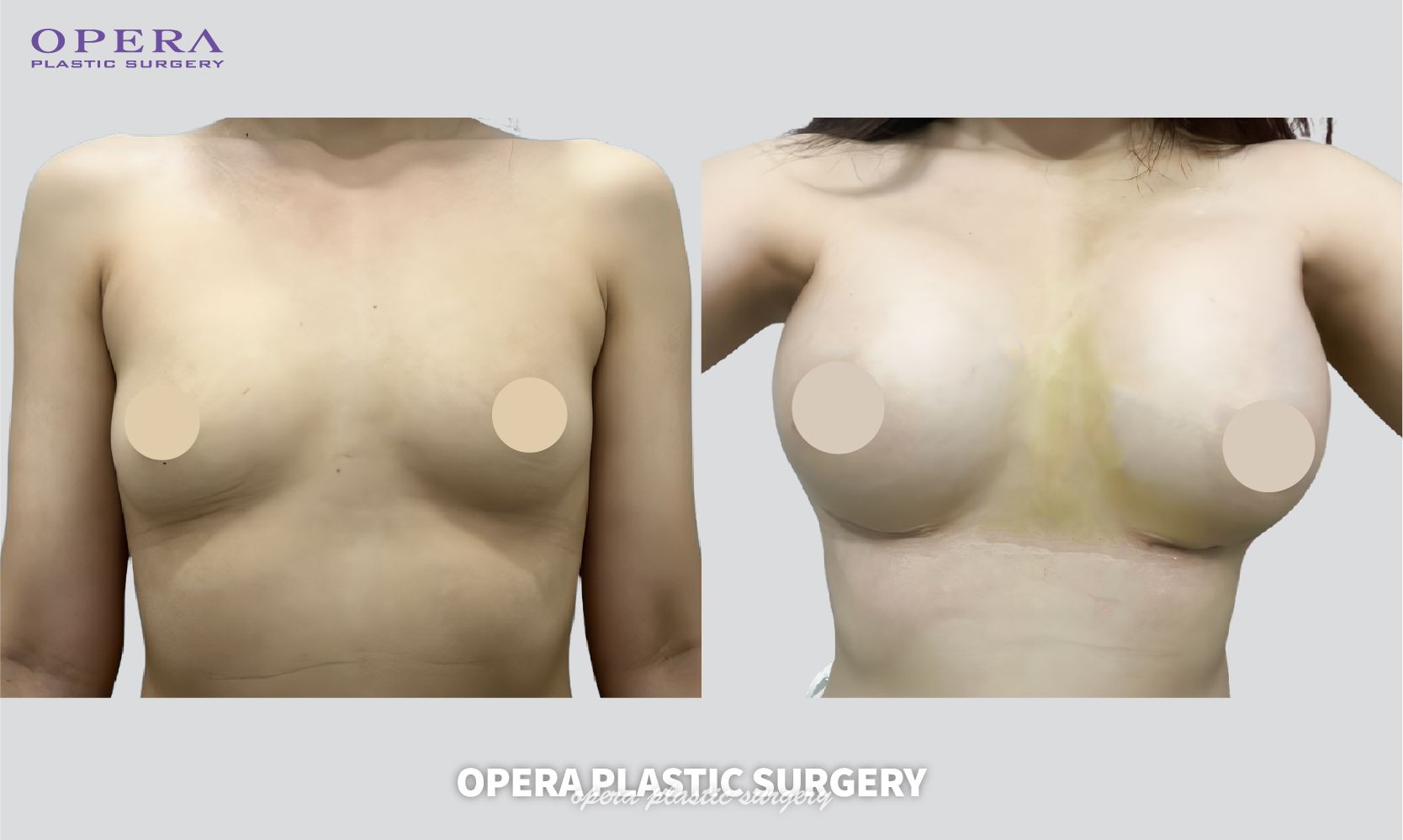 上海楊海平醫(yī)生坐診時間如何安排？