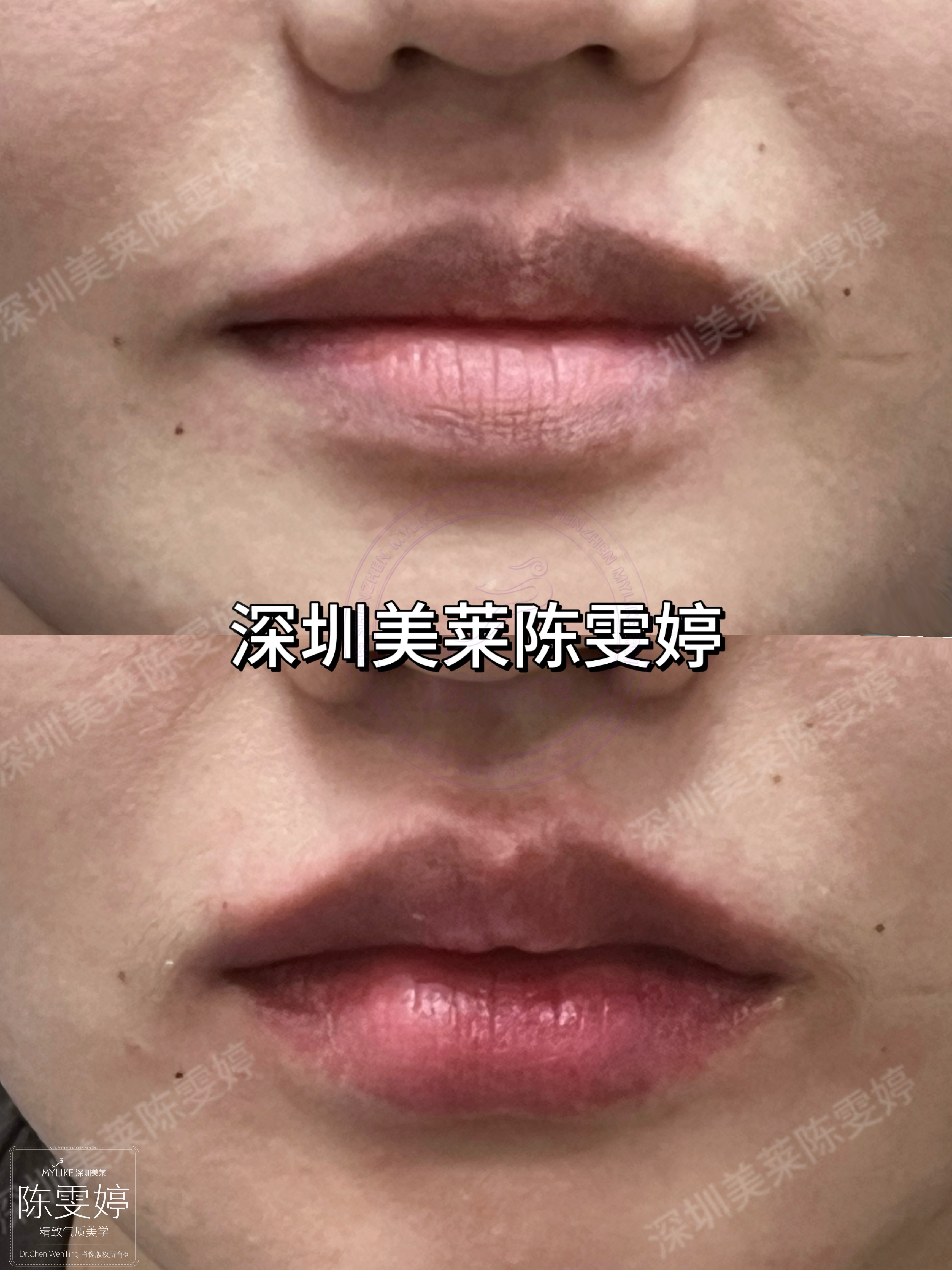 三、孫婧豐胸風格：自然柔軟派 vs 挺拔穩(wěn)定派