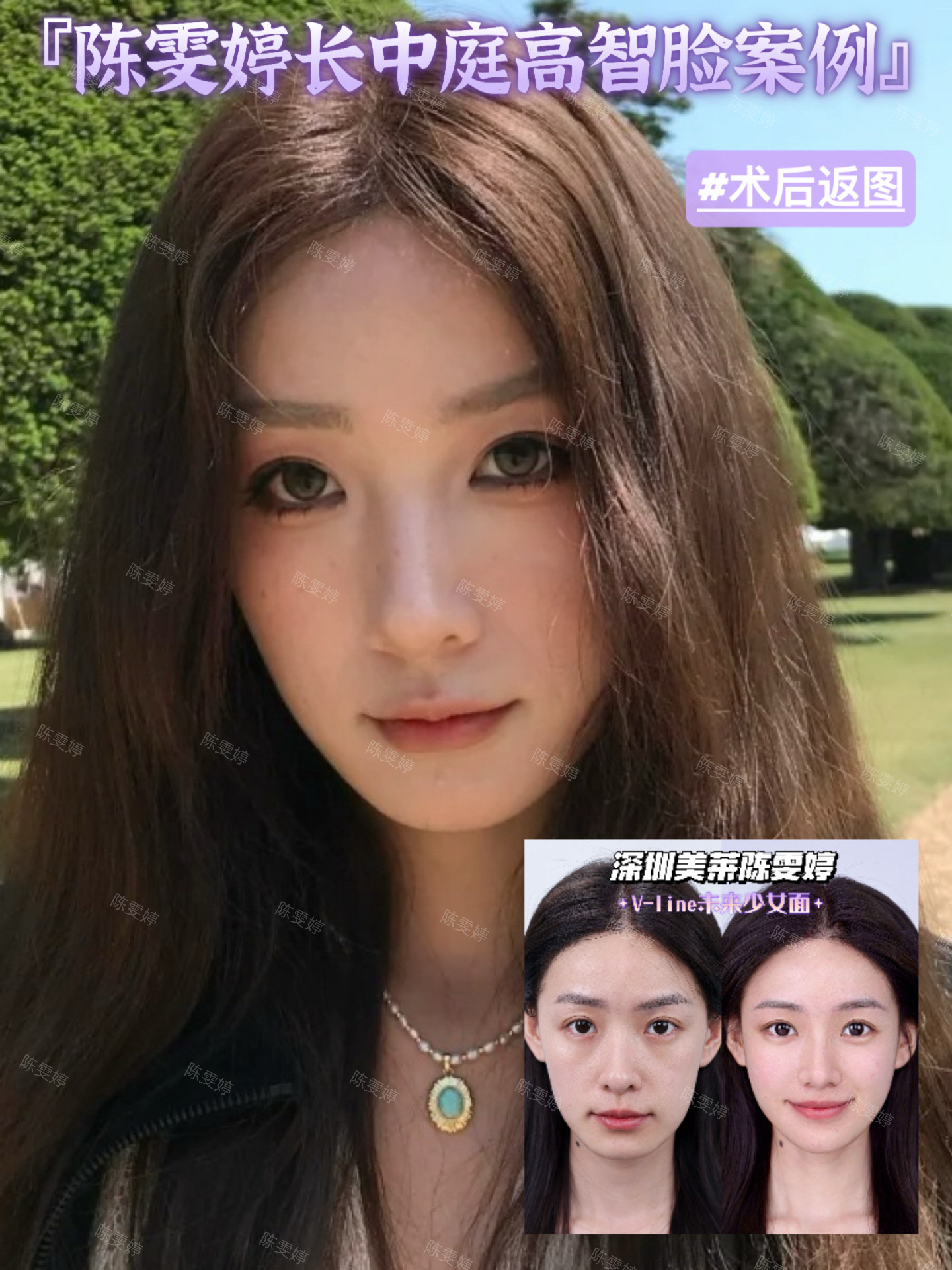 八、適合人群與術后建議m.sorencai.cn