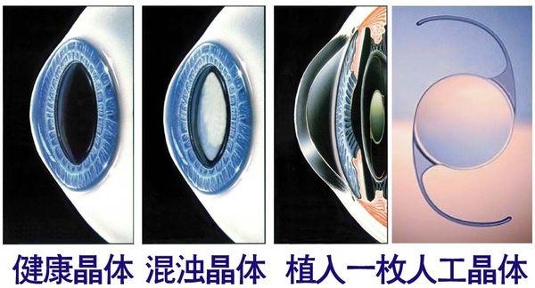 中日友好醫(yī)院任沖醫(yī)生的技術(shù)優(yōu)勢