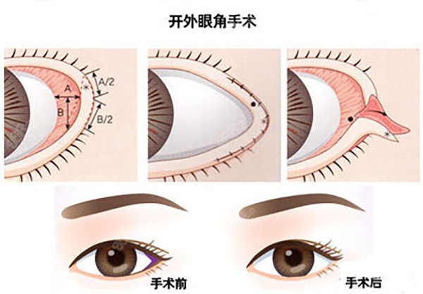 西南醫(yī)院美容整形科價目表|地址在哪里|是外包的嗎?：絕非外包！地址沙坪