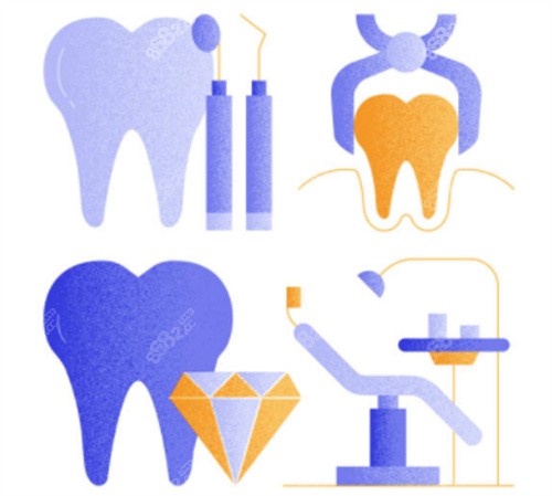種植牙各個模型圖 種植牙各個模型圖
