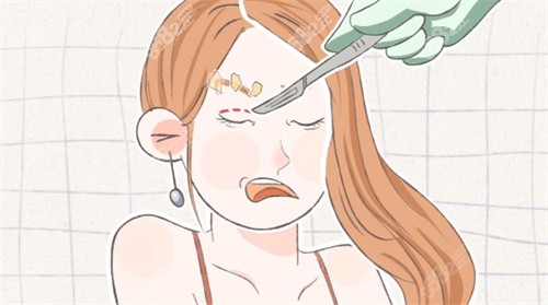 雙眼皮手術(shù)失敗修復(fù)卡通圖片