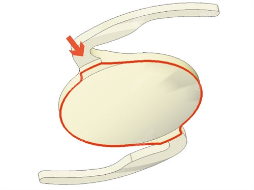 日本尼德克晶體示意圖