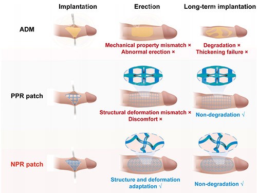 重慶星榮呂巍男科手術做的好嗎？ 2026呂巍院長男性私密增大增粗/功能提升