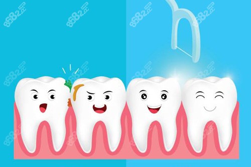 洗牙示意圖