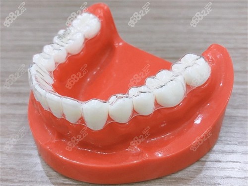 牙齒矯正隱形牙套模型圖 牙齒矯正隱形牙套模型圖