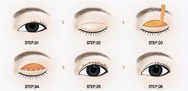 上海顧建成醫(yī)生怎么樣呢