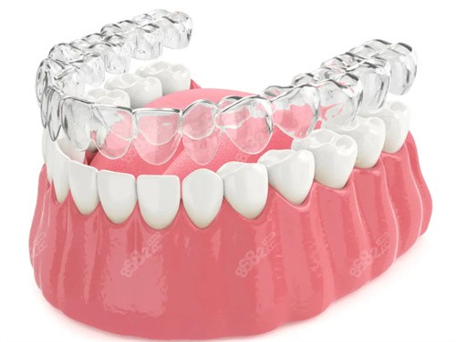 2026隱形牙齒矯正器品牌排行榜： 時(shí)代天使、隱適美、正雅優(yōu)缺點(diǎn)對比