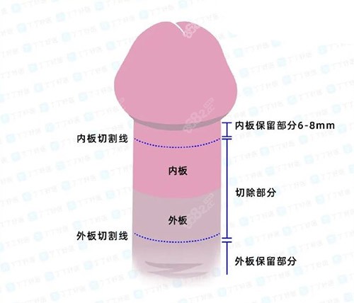男性陰莖照片 男性陰莖照片