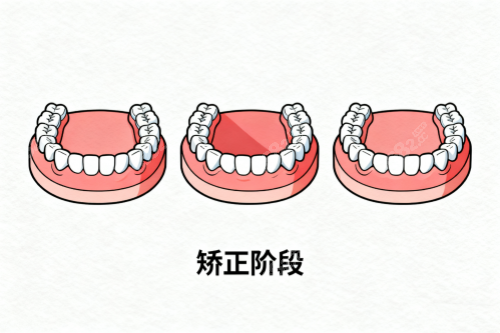 牙齒矯正成果展示