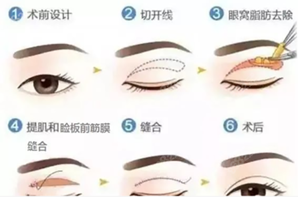 西南醫(yī)院美容整形科價(jià)目表|地址在哪里|是外包的嗎 西南醫(yī)院美容整形科價(jià)目表|地址在哪里|是外包的嗎