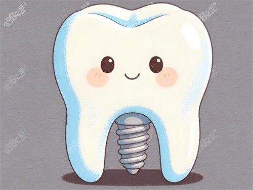 種植牙卡通展示照片圖