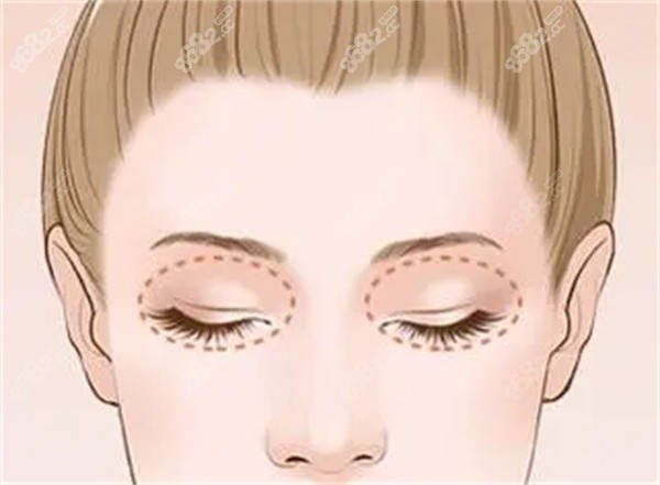 上海顧建成醫(yī)生做的面吸究竟有多驚艷 上海顧建成醫(yī)生做的面吸究竟有多驚艷