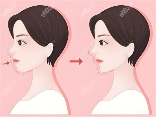 牙齒矯正前后對(duì)比 牙齒矯正前后對(duì)比