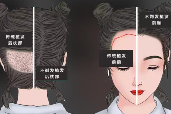 2026年國內(nèi)十佳植發(fā)正規(guī)醫(yī)院最新排行榜出爐！權(quán)威機(jī)構(gòu)推薦、安全技術(shù)對(duì)比與植發(fā)效果全解析