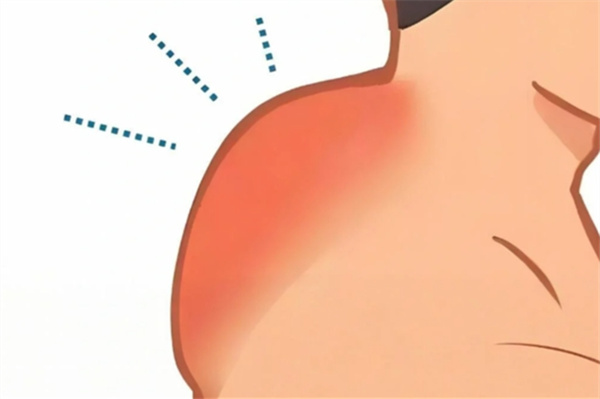 成都富貴包手術(shù)最厲害三個地方在友誼、八大處、軍大整形！附各院除富貴包技術(shù)價格一覽