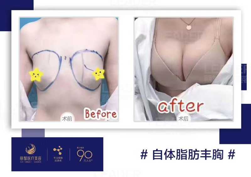 術(shù)后護(hù)理的重要性