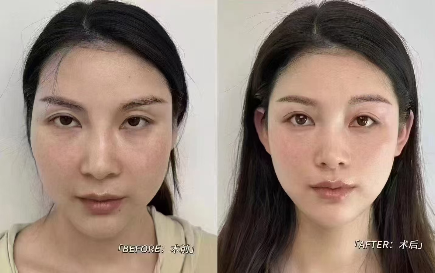 五、成都軍大整形美容醫(yī)院優(yōu)勢(shì)