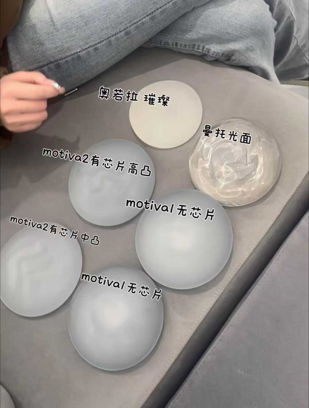 廣州可玉醫(yī)療美容醫(yī)院(唐志榮醫(yī)生):DV技術(shù)改善下垂平胸