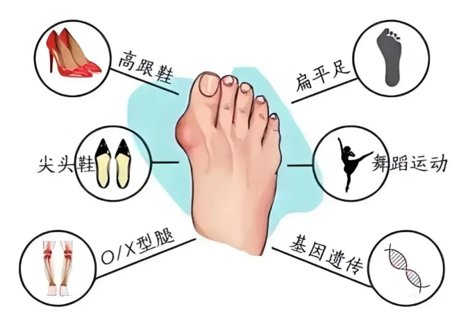 術(shù)后康復要點：科學護理才能鞏固效果