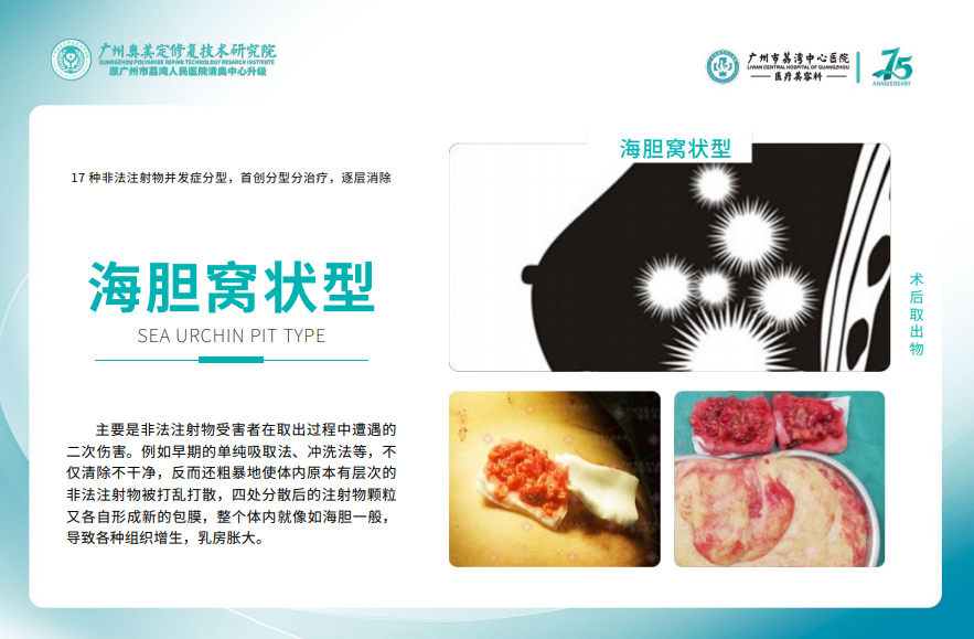 丁小邦是正規(guī)的醫(yī)生嗎？查證：醫(yī)學博士背景，專注高難度異物取出