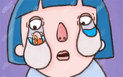 眼袋動(dòng)畫(huà)圖 眼袋動(dòng)畫(huà)圖