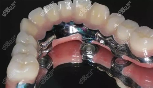 冠縣慶華嘉德口腔正規(guī)嗎？資質(zhì)齊全環(huán)境好，種植矯正兒牙都擅長(zhǎng)