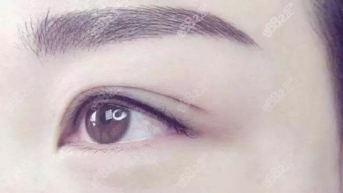 雙眼皮實(shí)拍 雙眼皮實(shí)拍