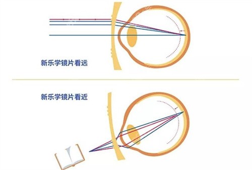 豪雅新樂學(xué)和蔡司哪個好？離焦技術(shù)、耐磨度及防控結(jié)果實測揭秘