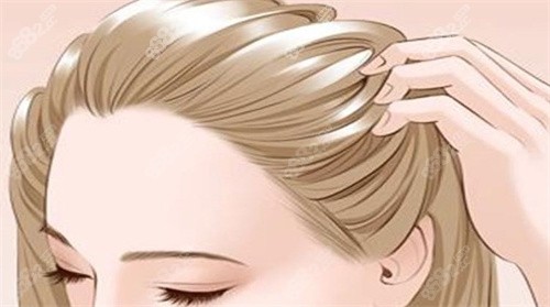 碧蓮盛植發(fā)和雍禾植發(fā)哪個(gè)好？ 2026兩大植發(fā)巨頭技術(shù)/單價(jià)/成活率對(duì)比