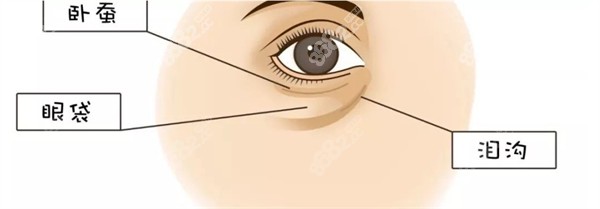 眼部臥蠶眼袋淚溝位置示意圖 眼部臥蠶眼袋淚溝位置示意圖