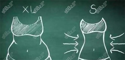 腹壁整形卡通對(duì)比展示 腹壁整形卡通對(duì)比展示