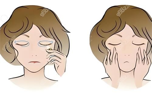 王楊修復眼袋貴嗎？ 2026鄭州王楊醫(yī)生祛眼袋技術(shù)、維持時間及掛號指南