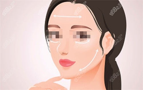 拉皮手術(shù)后面部提拉展示圖