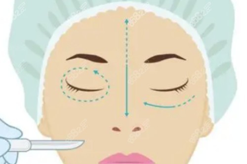 割眼袋卡通圖 割眼袋卡通圖