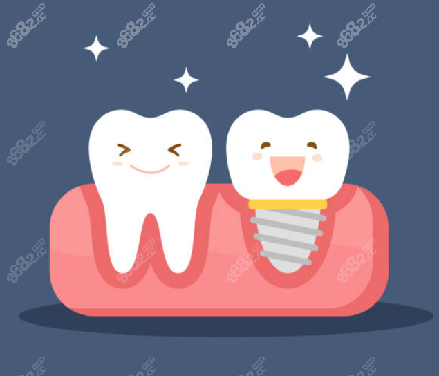 種植牙和正常牙齒圖 種植牙和正常牙齒圖