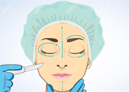 雙眼皮手術(shù)方案設(shè)計 雙眼皮手術(shù)方案設(shè)計